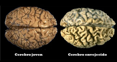 ¿Cuál es la relación entre ejercicio físico y mental con el envejecimiento?