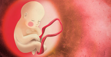 Dar a luz con una partera, ¿transgresión o derecho?