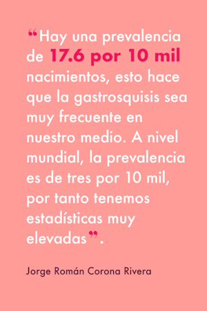 Gastrosquisis, el defecto congénito que desafía a la perinatología en México
