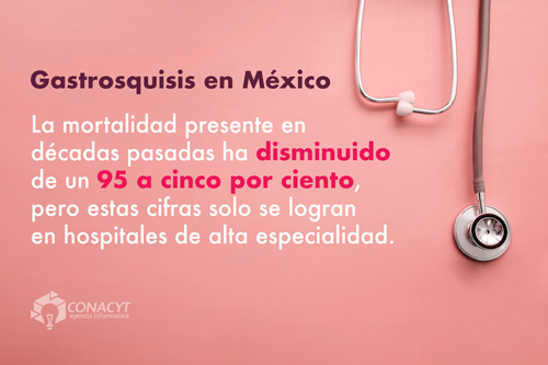 Gastrosquisis, el defecto congénito que desafía a la perinatología en México