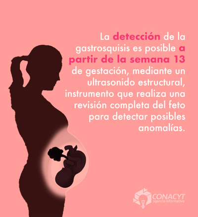 Gastrosquisis, el defecto congénito que desafía a la perinatología en México