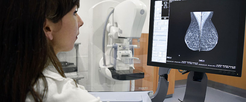 La prevención del cáncer es posible en cuatro de cada diez casos