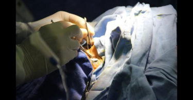 Busca IMSS aumentar donaciones de órganos y trasplantes
