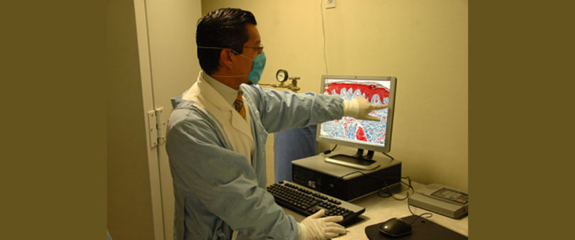 Desarrollan técnica para regenerar tejido en personas con quemaduras