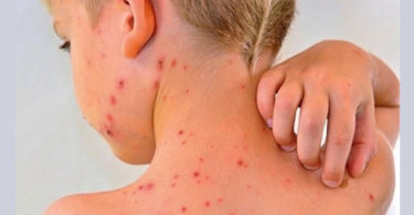 Alertan sobre iniciativas antivacunas en México