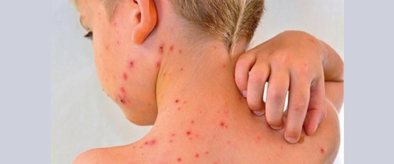 Alertan sobre iniciativas antivacunas en México