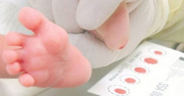 Reconoce Alcocer que sí suspendió la aplicación del tamiz neonatal