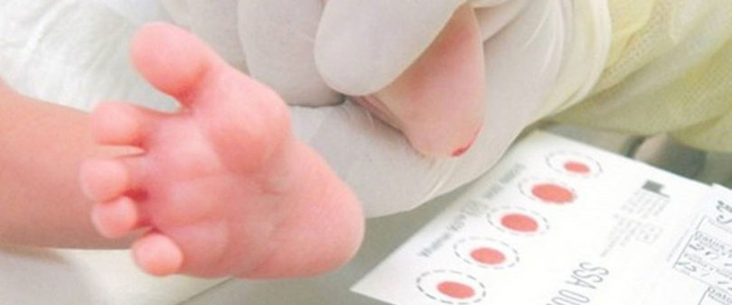 Reconoce Alcocer que sí suspendió la aplicación del tamiz neonatal
