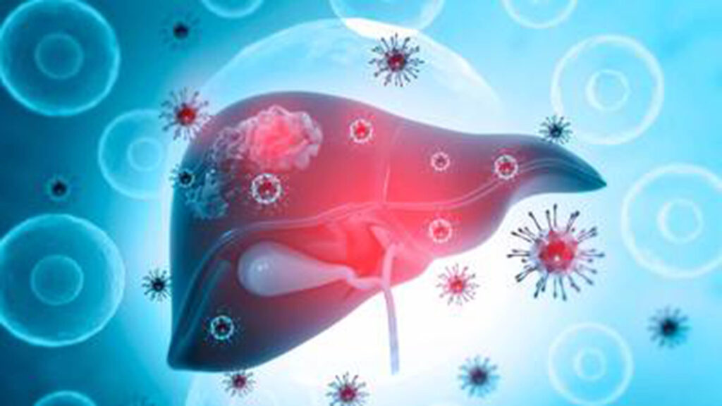 Hepatitis (2)