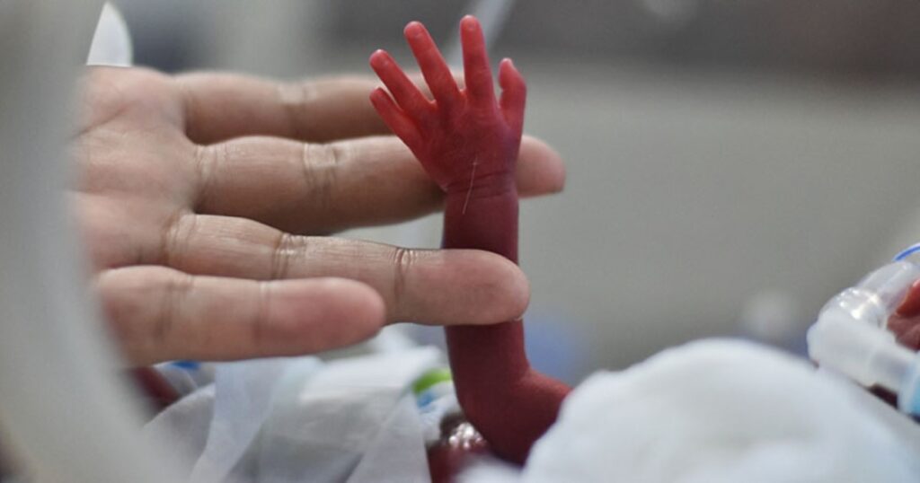 Bebés prematuros_NIH