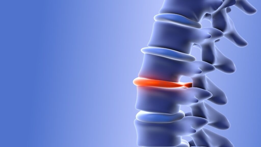 Disco-lumbar_Houston-Methodist-Hospital