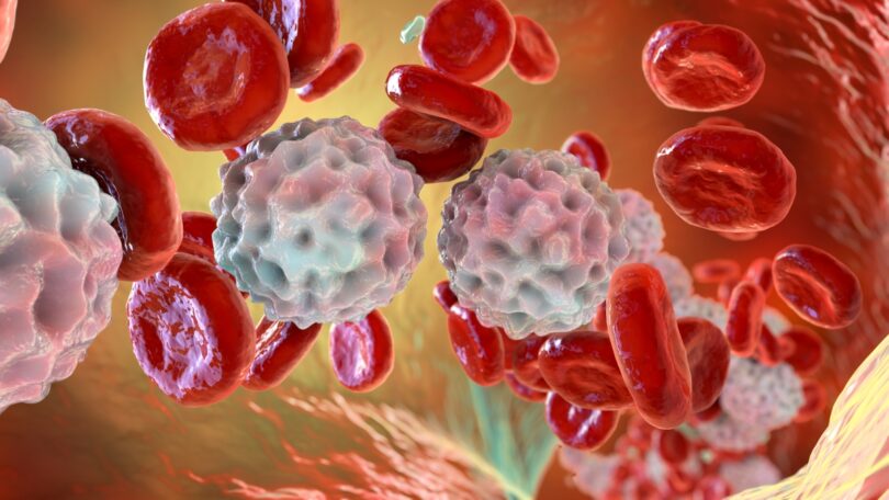 Leucemia-Linfoblastica-Aguda_AMGEN